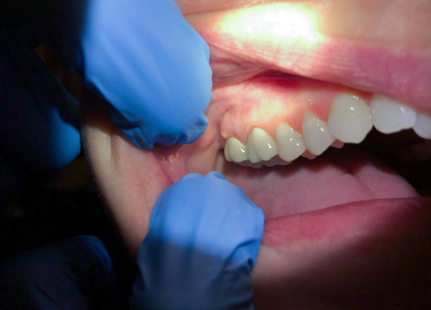 Dentist for Dental Trauma in CT